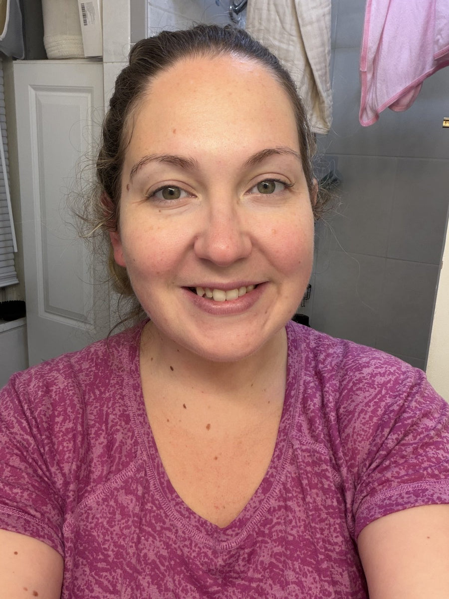 Smiling woman showing her fresh makeup-free skin