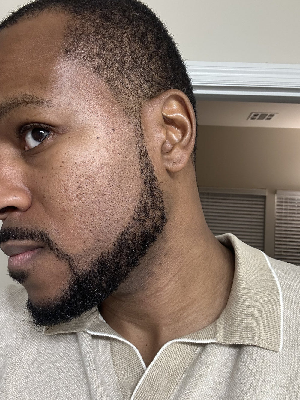 Close-up side profile showing a neatly groomed beard and smooth moisturized skin along the cheek and neck