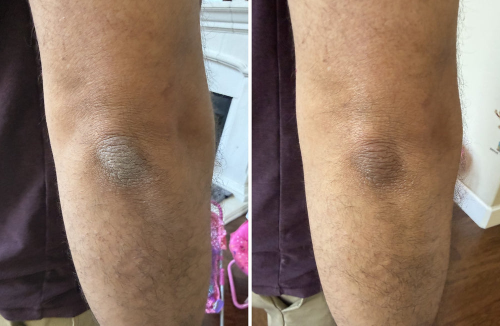 A customer's husband's elbow with a dry, ashy, rough patch before, and smoother, moisturized skin right after applying OILTEA